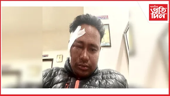 new ap web 11-11-24 new 2