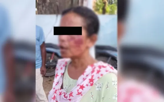 মেঘালয়ৰ আগ্ৰাসনক কেন্দ্ৰ কৰি মহিলাক মাৰধৰ...