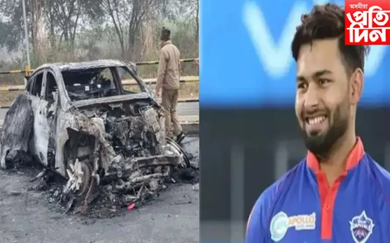 দুৰ্ঘটনাত পতিত ক্ৰিকেটাৰ ঋষভ পন্ট, কৰা হ'ব প্লাষ্টিক চাৰ্জাৰী...