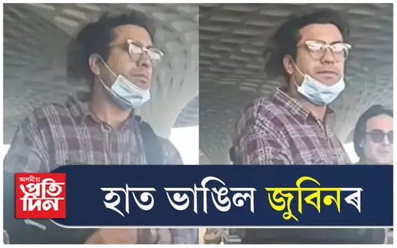 দুৰ্ঘটনাত হাত ভাঙিল জুবিনৰ... 