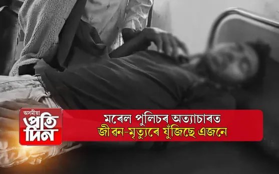 ৰাজ্যত পুনৰ মৰেল পুলিচৰ দৌৰাত্ম্যঃ সংকটজনক অৱস্থাত চিকিৎসাধীন এজন...