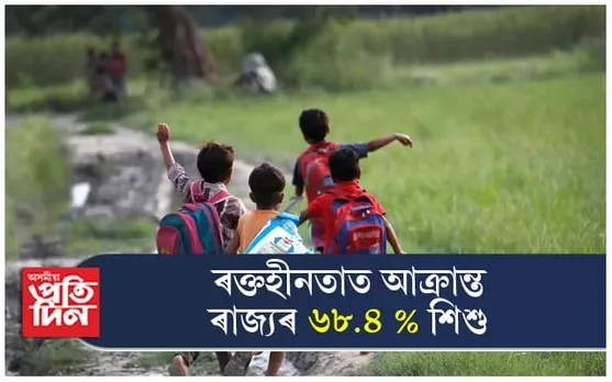 ৰক্তহীনতাত আক্ৰান্ত ৰাজ্যৰ ৬৮.৪ শতাংশ শিশু