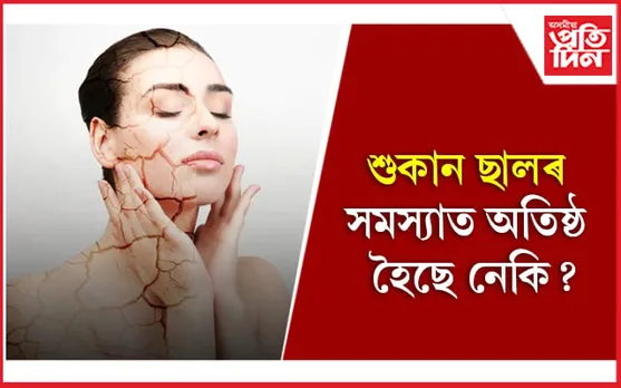 Skincare: এই খাদ্য খালে শীতকালতো চিকচিকাই থাকিব আপোনাৰ ছাল