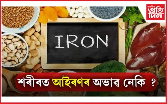 Iron Deficiency: ঘৰতে তৈয়াৰ কৰি খাওক আইৰণ সমৃদ্ধ এই খাদ্য