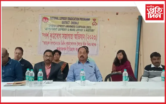 ধেমাজি জিলা স্বাস্থ্য বিভাগৰ উদ্যোগত কুষ্ঠৰোগ সজাগতা অভিযান সভা সম্পন্ন...