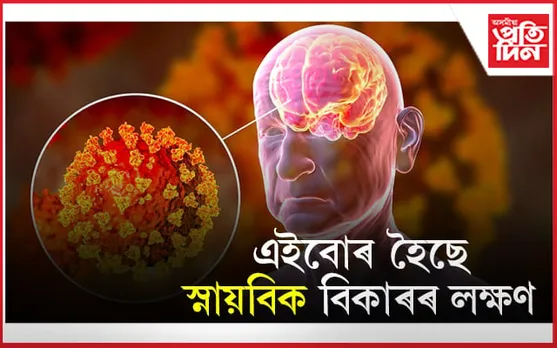 Corona: সাৱধান হওঁক, আৰোগ্য হোৱাৰ পিছতো কৰোনাই প্ৰভাৱিত কৰিছে মগজুক 