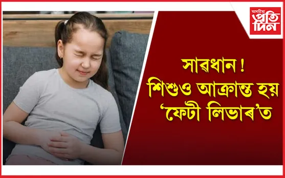 ‘ফেটী লিভাৰ’ৰ কাৰণ-লক্ষণসমূহ চিনাক্ত কৰি এইদৰে শিশুটোৰ যত্ন লওঁক