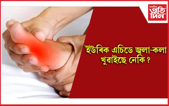 ইউৰিক এচিড নিয়ন্ত্ৰণত ৰাখিবলৈ খাওঁক এইসমূহ শুকান ফল