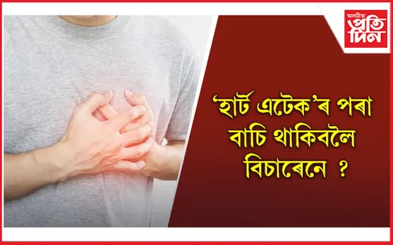 এইসমূহ অভ্যাস কৰি হৃদযন্ত্ৰ সুৰক্ষিত কৰি ৰাখক