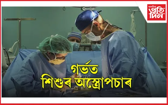 মাত্ৰ ৯০ ছেকেণ্ডঃ গৰ্ভতে শিশুৰ হৃদযন্ত্ৰৰ অস্ত্ৰোপচাৰ কৰি সফলতা লাভ চিকিৎসকৰ