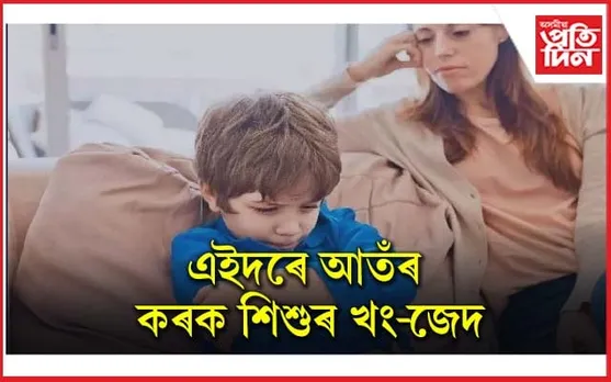 শিশুটিক মাৰ-পিট নকৰিব