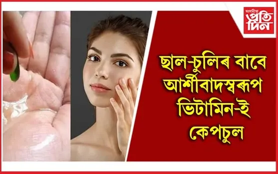 সৌন্দৰ্য বৰ্ধনত ভিটামিন ই কেপচুল কিদৰে ব্যৱহাৰ কৰিব, জানি লওক
