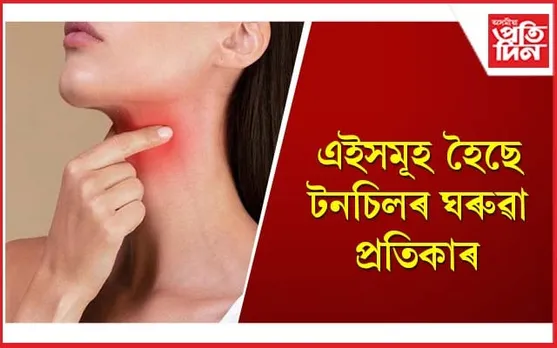 টনচিল সোনকালে ভাল নোহোৱাটো গুৰুতৰ ৰোগৰ লক্ষণ