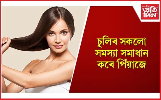 চুলিৰ যতনত পিঁয়াজৰ ভূমিকা