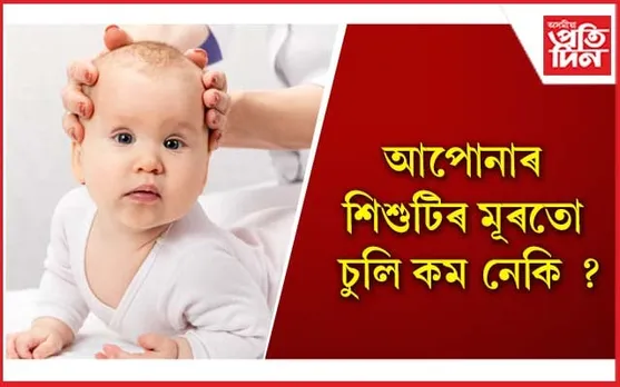 এইদৰে লওক শিশুটিৰ চুলিৰ যতন