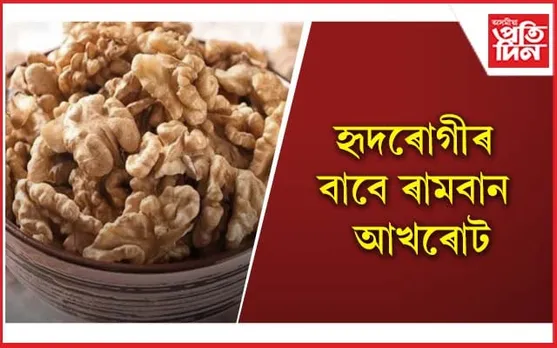 Heart Health: বহু স্বাস্থ্যজনিত সমস্যা দূৰ কৰাত সহায়ক এইবিধ ফল