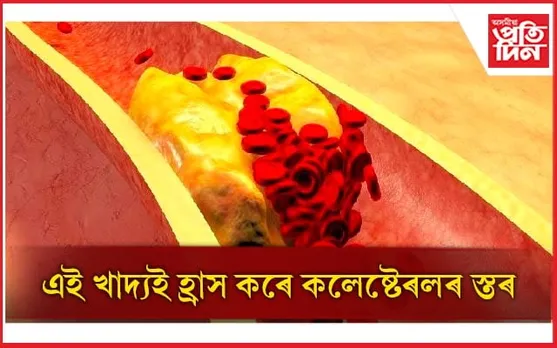 আজিয়েই সলনি কৰক আপোনাৰ খাদ্য তালিকা 