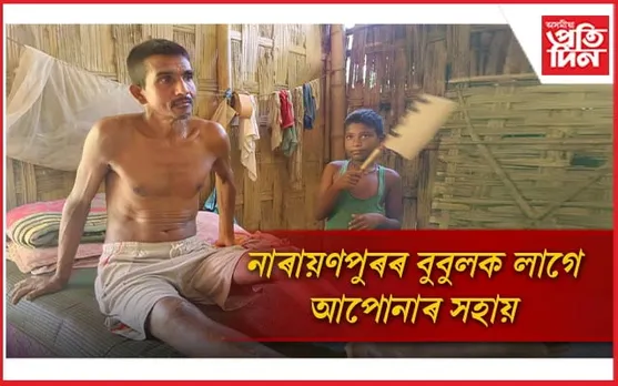 দুৰ্ঘটনাৰ বলি হৈ চাৰি মাহে পৰি আছে বিচনাতঃ নাই ৰেচন কাৰ্ড, আয়ুস্মান কাৰ্ড...