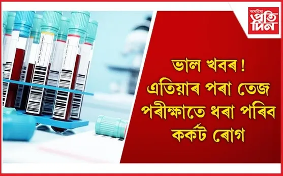 একেলগে চিনাক্ত হ’ব ৫০ প্ৰকাৰৰ কৰ্কট ৰোগ, নতুন পৰীক্ষাই আনিছে আশাৰ বতৰা
