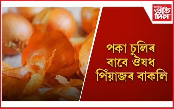 চুলিত পিঁয়াজৰ বাকলি কিদৰে ব্যৱহাৰ কৰিব পাৰি জানি লওঁক