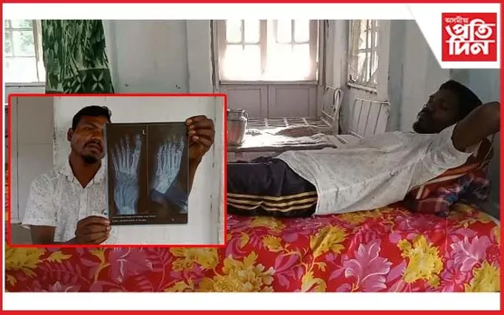 বোকাখাতত চিকিৎসাৰ বিসংগতি ! ভৰি ভঙাৰ পিছতো সুস্থ বুলি জনালে চিকিৎসকে...