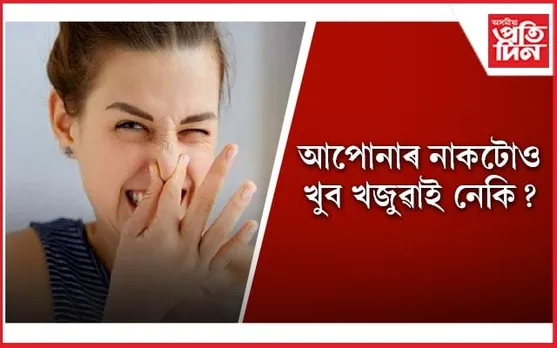 এইসমূহ ঘৰুৱা প্ৰতিকাৰৰে দূৰ কৰক নাকৰ খজুৱতিৰ সমস্যা