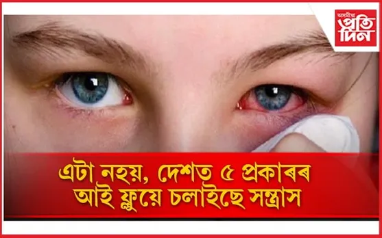 সকলো প্ৰকাৰৰ আই ফ্লুৰ লক্ষণ জানি লৈ সৰ্তক হওঁক 