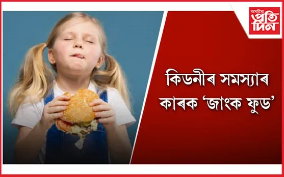 সন্তানক খাবলৈ দিওঁতে অভিভাৱকসকল সাৱধান হওঁক