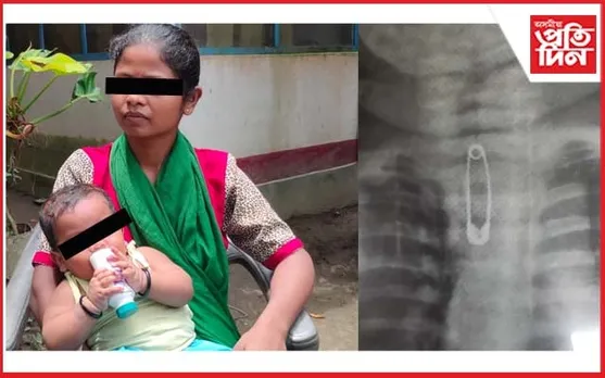 ছেপ্টিপিন খোৱা সাতমহীয়া শিশুৰ সাত দিনৰ মৰণকাতৰ সংগ্ৰাম...