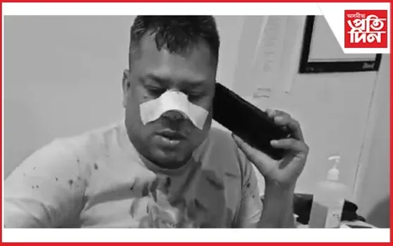 বিজেপি কৰ্মীৰ আক্ৰমণত আঘাতপ্ৰাপ্ত আপৰ যুৱ নেতা