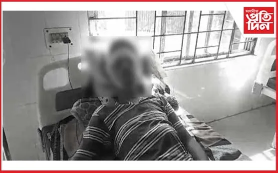 পিতৃৰ চুৰিকাঘাতত আহত পুত্ৰ