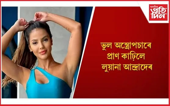 লুয়ানাৰ আকস্মিক বিয়োগত মৰ্মাহত সমগ্ৰ বিশ্ব