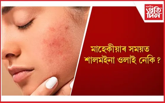 মাহেকীয়াৰ কেইদিনত এইদৰে লওঁক ছালৰ যতন