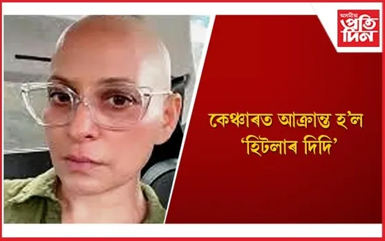 গ্ৰীৱাৰ কৰ্কট ৰোগ কি, ইয়াৰ লক্ষণবোৰৰ বিষয়ে আপুনিও জানি লওঁক