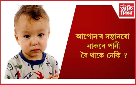 ঠাণ্ডা দিনত শিশুৰ নাকৰ সমস্যাৰ পৰা সমাধান পোৱাৰ সহজ উপায়কেইটা জানি লওঁক