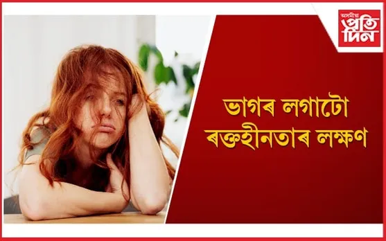 আইৰণৰ অভাৱ দূৰ কৰিবলৈ সন্তানক খাবলৈ দিয়ক এই ৬ বিধ খাদ্য