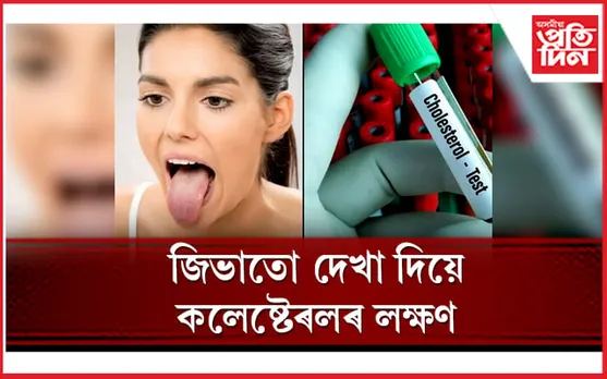 জিভাত এই সাতটা লক্ষণ দেখিলে সাৱধান হ’ব