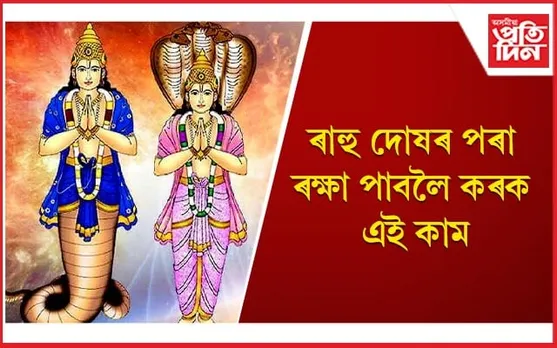 আপুনিও ৰোগীয়া, লোকচানৰ সন্মুখীন হৈ ভাগৰিছে নেকি ?