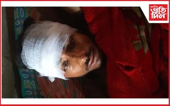 কোকৰাঝাৰত যুৱকক আক্ৰমণঃ গুৰুতৰভাৱে আহত...