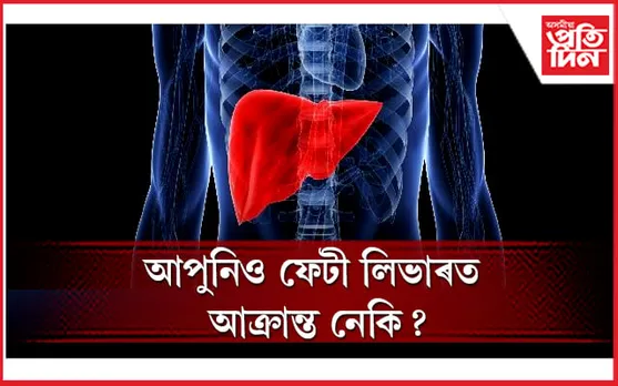 কি খাদ্যয়ে এই ৰোগৰ পৰা আপোনাক বচাই ৰাখিব পাৰে জানেনে ?