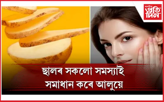 বহু গুণৰে সমৃদ্ধ আলু, আপুনিও জানি লওঁক