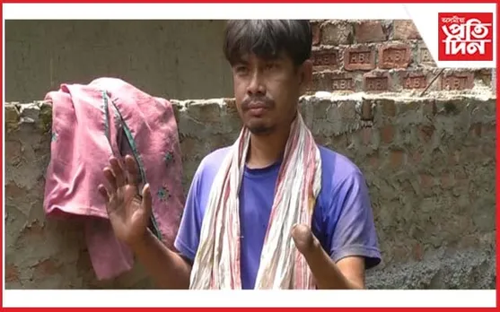 দিব্যাংগ হৈয়ো লাভ নকৰে চৰকাৰী সুবিধাঃ  বাওঁ হাতৰ আঙুলি নথকাৰ বাবেই কৰ্তন ৰেচন কাৰ্ড