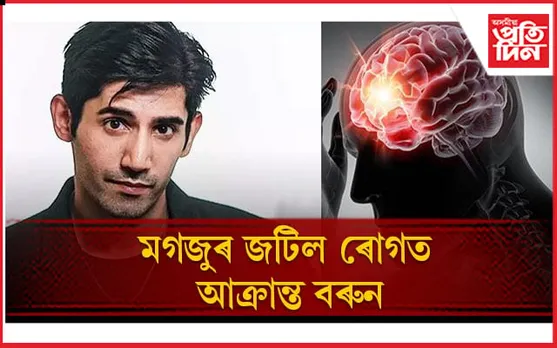 মূৰত আঘাত পালে সহজভাৱে নল'ব, অন্যথা ভূগিব পাৰে গুৰুতৰ ৰোগত