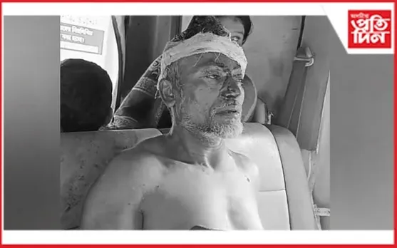 গৰু চোৰক গ্ৰেপ্তাৰ কৰিবলৈ গৈ গুৰুতৰভাৱে আহত মহিলা কনিষ্টবল সহ উপ পৰিদৰ্শক...