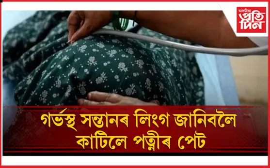 পুত্ৰৰ লালসা ! অৱশেষত কৰ্মৰ ফল পাষাণ পিতৃয়ে