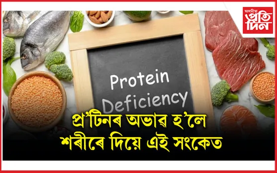 শৰীৰক পৰ্যাপ্ত প্ৰটিন যোগানৰ বাবে কি খাব লাগে জানি লওঁক
