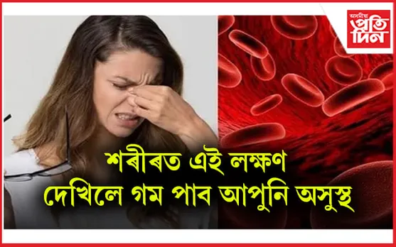 হিম’গ্লবিনৰ অভাৱ দূৰ কৰিবলৈ কি খাব লাগে জানেনে ? 
