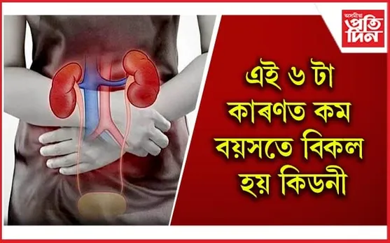 সময় থাকোতেই সাৱধান হওঁক, জীৱনশৈলী সলনি কৰক