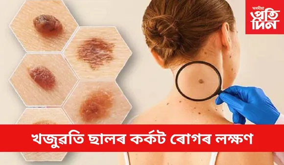 শৰীৰত এই ৫টা লক্ষণ দেখিলে সাৱধান হ’ব