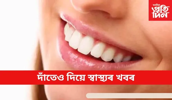 এই লক্ষণক সাধাৰণ বুলি ভাবিলে হেৰুৱাব আপোনাৰ প্ৰাণ 